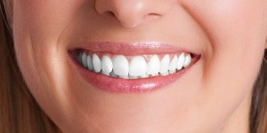 Beograd zubni implanti