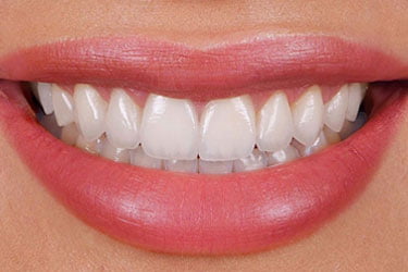 Dentaltourism